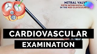 Cardiovascular Examination  OSCE Guide  UKMLA  CPSA [upl. by Jona343]