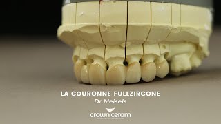 Présentation de la couronne FullZircone  Dr M [upl. by Lilaj118]