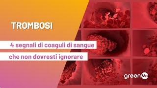 Trombosi 4 segnali di coaguli di sangue che non dovresti ignorare [upl. by Farly]