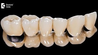 What is difference between composite and GIC cements in dentistry  Dr Harish B [upl. by Krm528]