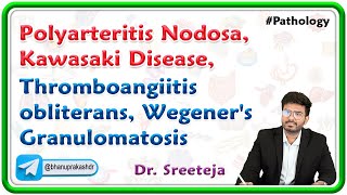 2 Polyarteritis Nodosa Kawasaki Disease Thromboangiitis obliterans Wegeners Granulomatosis [upl. by Agnola527]