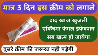 मात्र 1 क्रीम से दाद खाज खुजली 3 दिन में खत्म Best Ketoconazole Cream For Fungal Infection Problems [upl. by Aitnecserc]