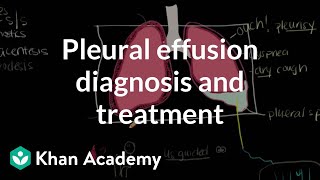 Pleural effusion diagnosis and treatment  Respiratory system diseases  NCLEXRN  Khan Academy [upl. by Kassie]