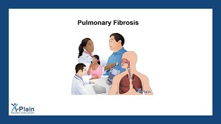 Pulmonary Fibrosis [upl. by Annadroj]