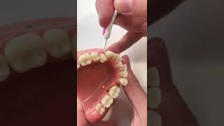 Using an Interdental Brush 2 [upl. by Aibun]