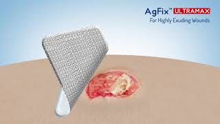 AGFIX Ultra Max Super Absorbent Hydrophilic Foam Silver Pad [upl. by Regen884]