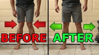 5 Ways To Fix Knocked Knees  Tight Inner Thighs [upl. by Chiarra]