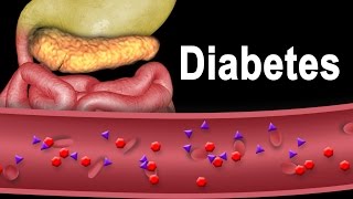 Diabetes Type 1 and Type 2 Animation [upl. by Mohr291]