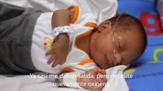 Bebé prematuro Daniel de 29 semanas de gestación [upl. by Ralip252]