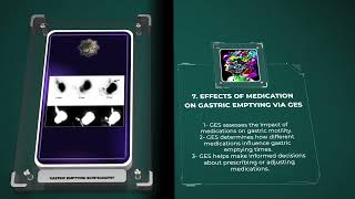 Gastric Emptying Scintigraphy [upl. by Nasia]