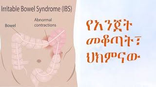 የአንጀት መቆጣት፣ ህክምናውIrritable Bowel Syndrome Treatment [upl. by Ahsoj118]