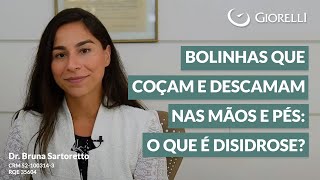 Sua pele coça mas parece não ter nada alergia alergista allergy coceira [upl. by Wrigley]