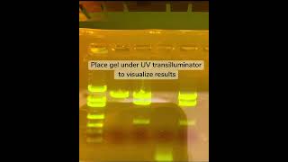 Gel Electrophoresis [upl. by Iives]