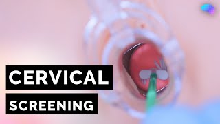 Cervical Screening Smear  HPV  OSCE Guide  UKMLA  CPSA [upl. by Barthold564]