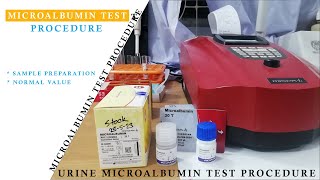 Microalbumin Test Procedure ।। Urine for MicroAlbumin Test Procedure MicroAlbumin Test [upl. by Sane899]