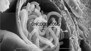 Oncocercosis BIOLOGÍA resumen  memorización [upl. by Attolrac]