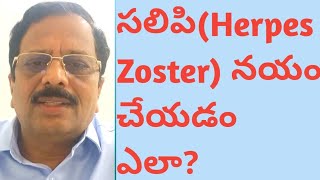 How to cure Herpes Zoster [upl. by Carolle]