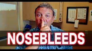 How To Deal With Nosebleeds  Pediatric Advice [upl. by Ylaek]