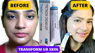 I Used Tretinoin for 1 Year and THIS happened  Tretinoin Update Pm Skin Care Routine with retinA [upl. by Ahsienat642]