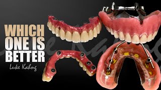 Which Full Mouth Implant Prosthetics Do I Prefer [upl. by Kenneth]