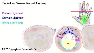 Dupuytren disease anatomy [upl. by Eastlake201]