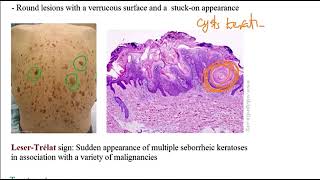 USMLE ACE Video 192 Skin Disorders Overview [upl. by Lletram67]