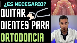 EXTRAER DIENTES para una ORTODONCIA  ¿Te han dicho de QUITAR los PREMOLARES ¿Es necesario [upl. by Rexanna]