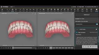 Invisaligns huge advantage in treatment efficiency versus braces [upl. by Strawn313]