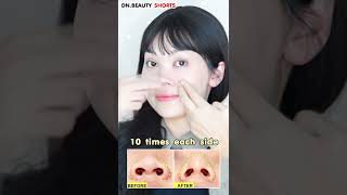 NASAL WING LIFT amp NOSE TIP LIFT MASSAGE  GET SLIM amp SMALL NOSE NATURALLY [upl. by Fredericka]