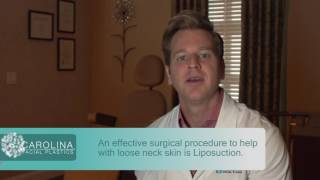 Surgical and NonSurgical Neck Lift Options [upl. by Ennire]