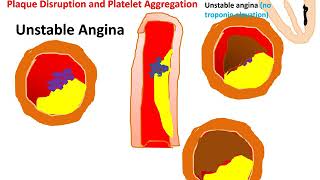 The Pharmacology of The Vasodilators amp The Treatment of Angina Pectoris 1 [upl. by Yelrac]