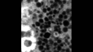 NIDCR Granules in a Salivary Acinar Cell [upl. by Spear]