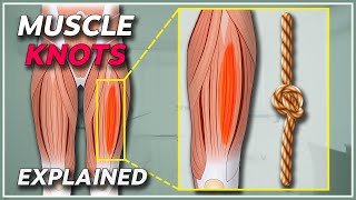 What is a muscle knot  Muscle knots amp trigger points explained [upl. by Akciret]