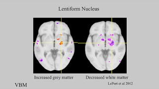 Extraordinary Variations of the Human Mind James McGaugh Highly Superior Autobiographical Memory [upl. by Norbie858]