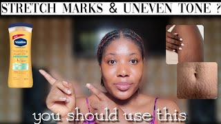 BEST VASELINE LOTION FOR STRETCH MARKS AND UNEVEN SKIN TONE [upl. by Trevlac170]