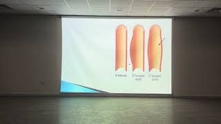 CVSPathology  Lec4  Aneurysm and dissection [upl. by Rothmuller]