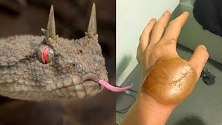 20 Most Painful Snake Bites In The World [upl. by Cotsen648]