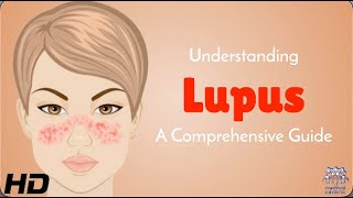 Lupus Awareness How You Can Make a Difference [upl. by Nozicka]