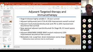 2022 ABSITE Review Surgical Oncology [upl. by Isola999]