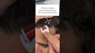 How To Use The StimuRoller Derm Roller  Micro needling for Hair Loss amp Stimulate Hair Growth [upl. by Cheston559]