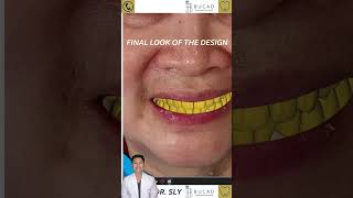 Transforming Smiles with CuttingEdge Technology [upl. by Rendrag]