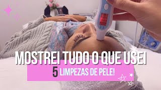 5 LIMPEZAS DE PELE  PRODUTOS QUE UTILIZEI [upl. by Aerdnod575]