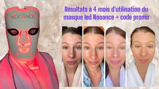 Masque led Nooance résultats à 4 mois code promo et black friday Ouaw😃 [upl. by Nagyam]