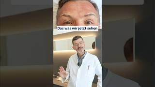 ￼￼ AugenbrauenLifting Browlifting OberlichtStraffung AnTaching PlastischeChirurgie facharzt [upl. by Ettenna]