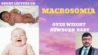 WHAT IS MACROSOMIA CAUSES OF OVER WEIGHT NEWBORN BABY FETAL MACROSOMIA [upl. by Akimot]