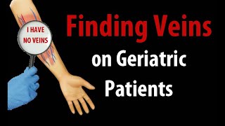 Help I Cant Find Veins on Geriatric Patients [upl. by Helse594]