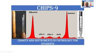 CHIPS 9  Esbachs Albuminometer  Pathology practicals  Instruments  MBBS  Paramedicals  SRM [upl. by Nalym]