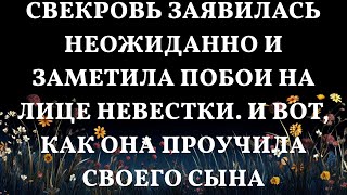 Свекровь заявилась неожиданно и заметила побои на лице невестки И вот как она проучила своего сы [upl. by Ailecnarf]