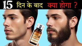 Ustraa Beard Growth Oil After 15 Days Review  Best Beard Oil For Patchy Beard in India 2024 [upl. by Fredericka292]