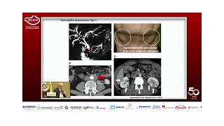 Pancreatitis crónica ¿Cómo la abordo yo Congreso presencial post pandemia de COVID19 [upl. by Giacopo]